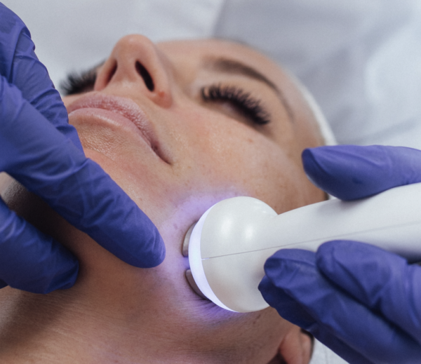 Higiene Facial con INDIBA Ona